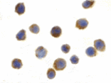 Immunocytochemistry - TSC1 Antibody from Signalway Antibody (24309) - Antibodies.com