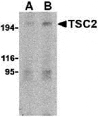 Western blot - TSC2 Antibody from Signalway Antibody (24311) - Antibodies.com