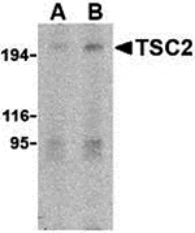 Western blot - TSC2 Antibody from Signalway Antibody (24311) - Antibodies.com