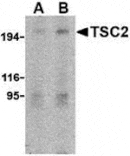 Western blot - TSC2 Antibody from Signalway Antibody (24311) - Antibodies.com