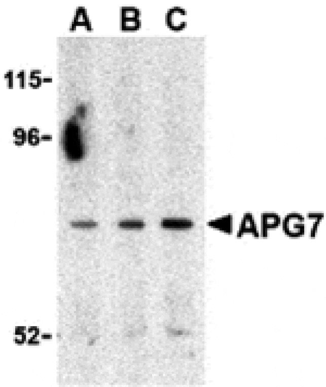 Western blot - APG7 Antibody from Signalway Antibody (24353) - Antibodies.com