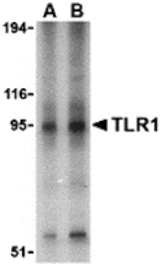 Western blot - TLR1 Antibody from Signalway Antibody (24362) - Antibodies.com