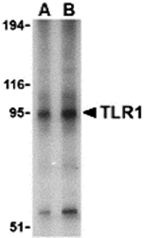 Western blot - TLR1 Antibody from Signalway Antibody (24362) - Antibodies.com