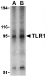 Western blot - TLR1 Antibody from Signalway Antibody (24362) - Antibodies.com