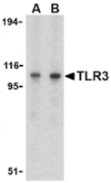 Western blot - TLR3 Antibody from Signalway Antibody (24363) - Antibodies.com