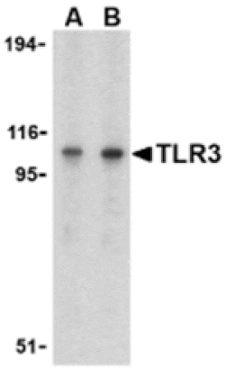 Western blot - TLR3 Antibody from Signalway Antibody (24363) - Antibodies.com