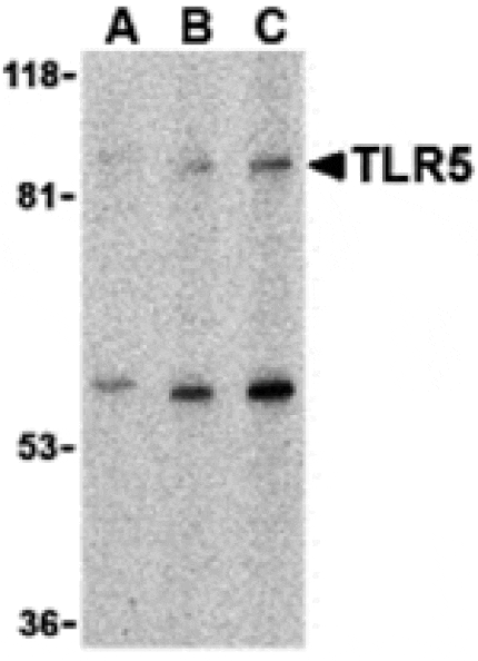 Western blot - TLR5 Antibody from Signalway Antibody (24366) - Antibodies.com