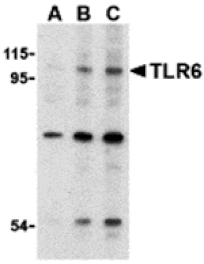 Western blot - TLR6 Antibody from Signalway Antibody (24367) - Antibodies.com