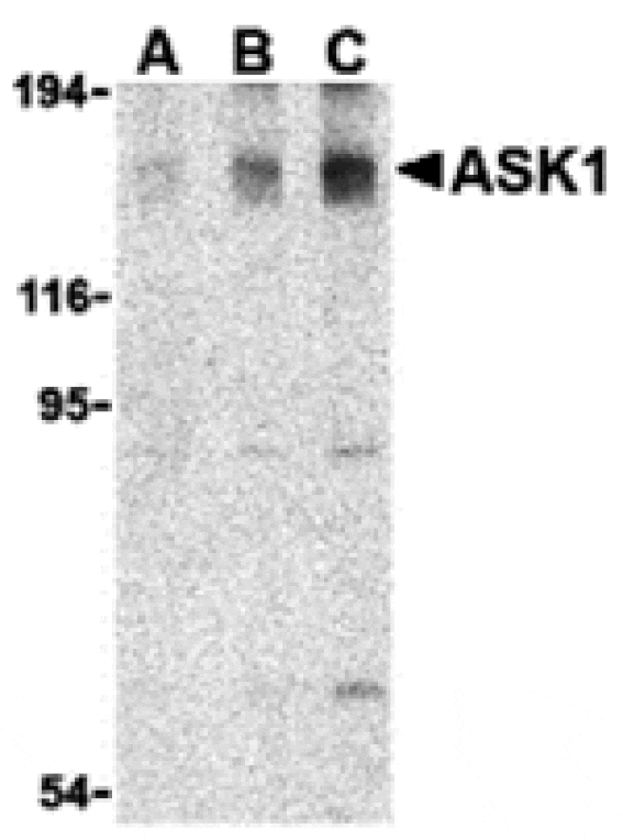 Western blot - ASK1 Antibody from Signalway Antibody (24380) - Antibodies.com