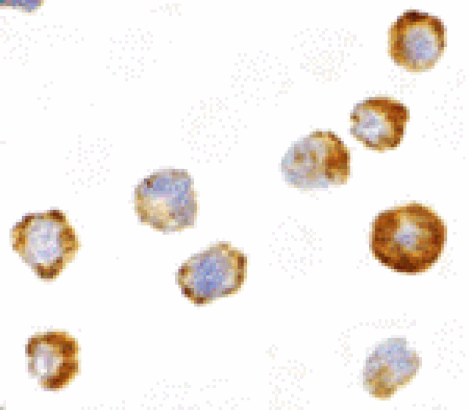 Immunocytochemistry - ASK1 Antibody from Signalway Antibody (24380) - Antibodies.com