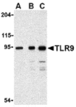 Western blot - TLR9 Antibody from Signalway Antibody (24387) - Antibodies.com