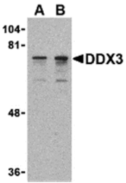 Western blot - DDX3 Antibody from Signalway Antibody (24395) - Antibodies.com