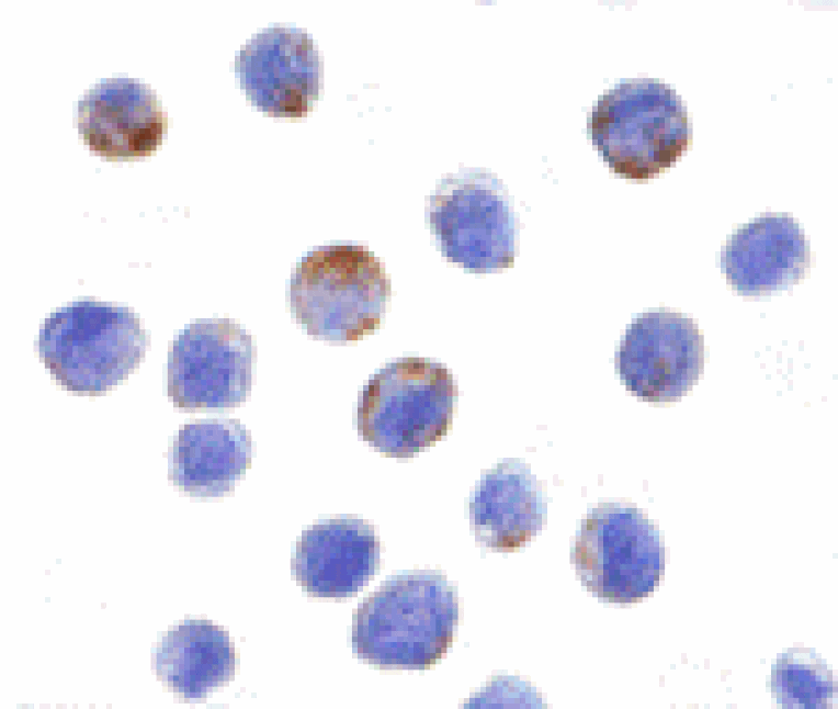 Immunocytochemistry - DDX3 Antibody from Signalway Antibody (24395) - Antibodies.com