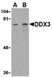 Western blot - DDX3 Antibody from Signalway Antibody (24396) - Antibodies.com