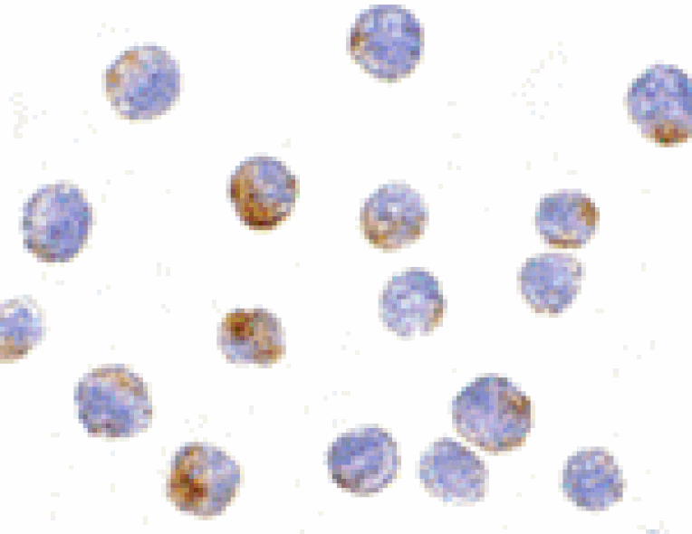 Immunocytochemistry - DDX3 Antibody from Signalway Antibody (24396) - Antibodies.com