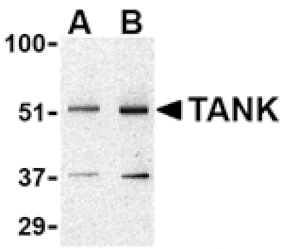 Western blot - TANK Antibody from Signalway Antibody (24438) - Antibodies.com