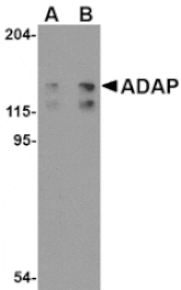 Western blot - ADAP Antibody from Signalway Antibody (24553) - Antibodies.com