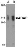 Western blot - ADAP Antibody from Signalway Antibody (24554) - Antibodies.com