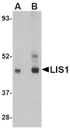 Western blot - LIS1 Antibody from Signalway Antibody (24558) - Antibodies.com