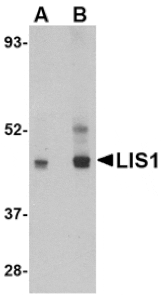 Western blot - LIS1 Antibody from Signalway Antibody (24558) - Antibodies.com