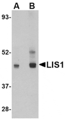 Western blot - LIS1 Antibody from Signalway Antibody (24558) - Antibodies.com