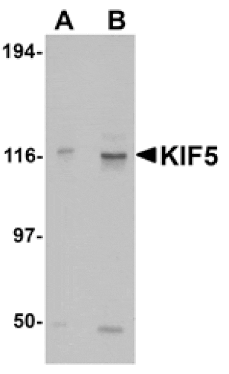 Western blot - KIF5 Antibody from Signalway Antibody (24559) - Antibodies.com