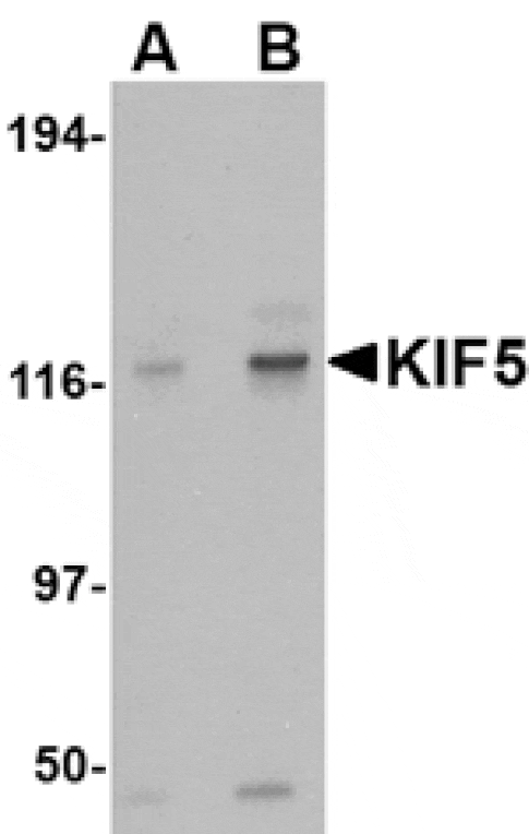 Western blot - KIF5 Antibody from Signalway Antibody (24560) - Antibodies.com