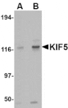 Western blot - KIF5 Antibody from Signalway Antibody (24560) - Antibodies.com