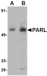 Western blot - PARL Antibody from Signalway Antibody (24739) - Antibodies.com