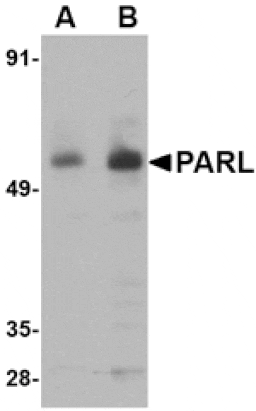 Western blot - PARL Antibody from Signalway Antibody (24739) - Antibodies.com