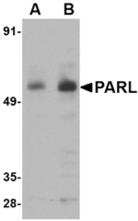 Western blot - PARL Antibody from Signalway Antibody (24739) - Antibodies.com