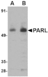 Western blot - PARL Antibody from Signalway Antibody (24739) - Antibodies.com