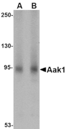 Western blot - Aak1 Antibody from Signalway Antibody (24772) - Antibodies.com