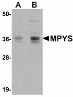 Western blot - MPYS Antibody from Signalway Antibody (24935) - Antibodies.com