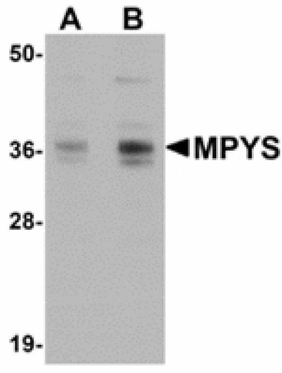 Western blot - MPYS Antibody from Signalway Antibody (24935) - Antibodies.com