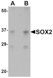 Western blot - SOX2 Antibody from Signalway Antibody (25044) - Antibodies.com