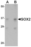 Western blot - SOX2 Antibody from Signalway Antibody (25044) - Antibodies.com