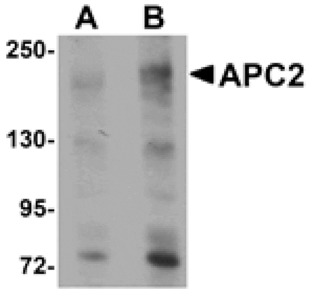 Western blot - APC2 Antibody from Signalway Antibody (25101) - Antibodies.com