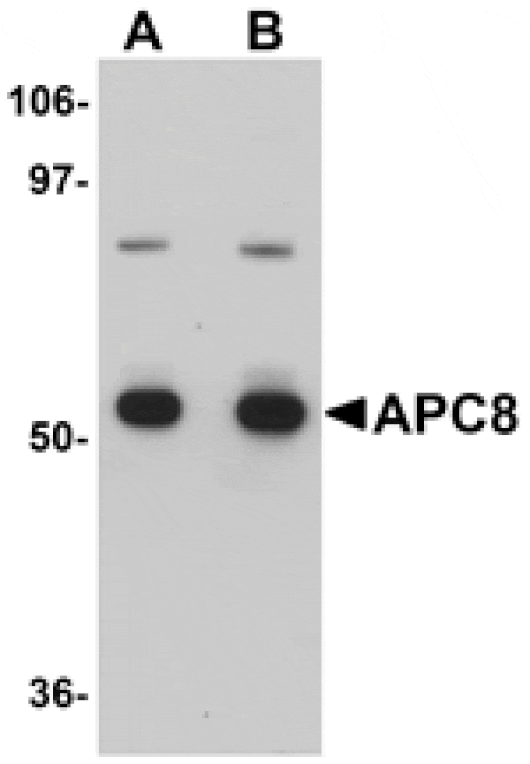 Western blot - APC8 Antibody from Signalway Antibody (25107) - Antibodies.com