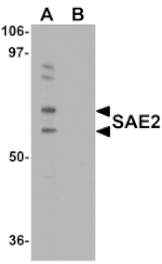 Western blot - SAE2 Antibody from Signalway Antibody (25116) - Antibodies.com