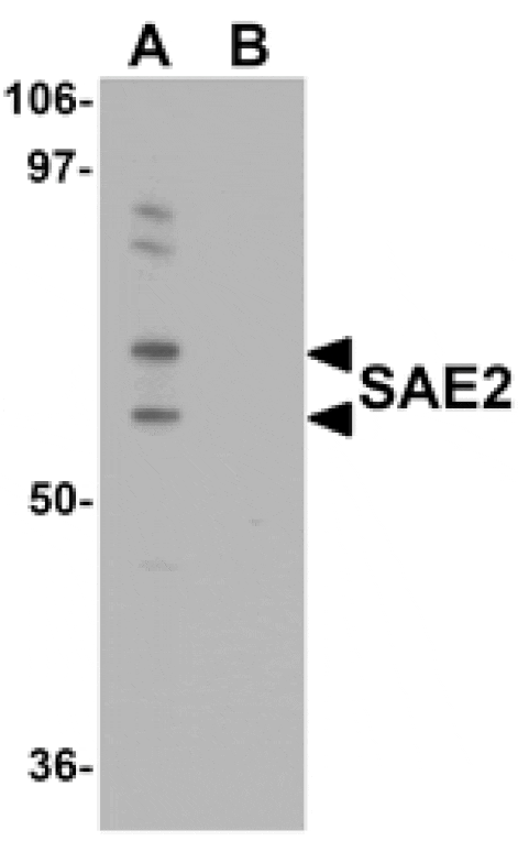 Western blot - SAE2 Antibody from Signalway Antibody (25116) - Antibodies.com