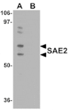Western blot - SAE2 Antibody from Signalway Antibody (25116) - Antibodies.com