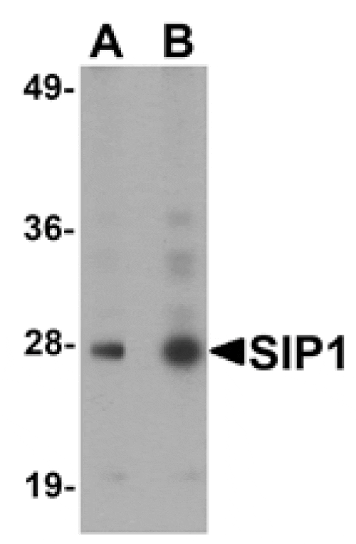 Western blot - SIP1 Antibody from Signalway Antibody (25143) - Antibodies.com