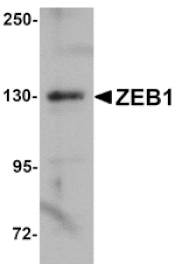 Western blot - ZEB1 Antibody from Signalway Antibody (25144) - Antibodies.com