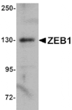 Western blot - ZEB1 Antibody from Signalway Antibody (25144) - Antibodies.com