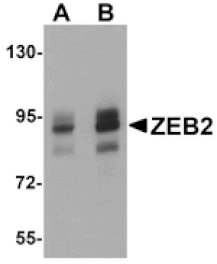 Western blot - ZEB2 Antibody from Signalway Antibody (25145) - Antibodies.com