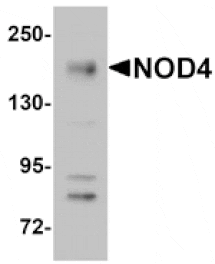 Western blot - NOD4 Antibody from Signalway Antibody (25176) - Antibodies.com