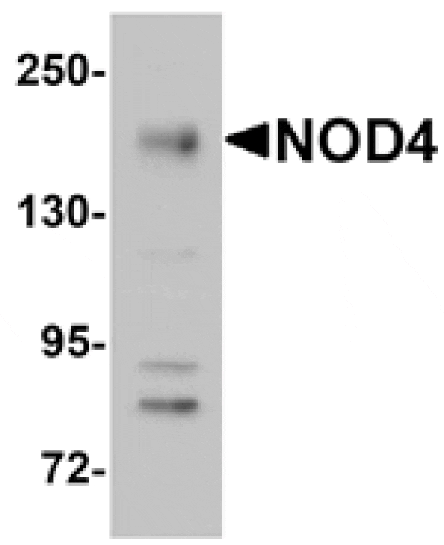 Western blot - NOD4 Antibody from Signalway Antibody (25176) - Antibodies.com