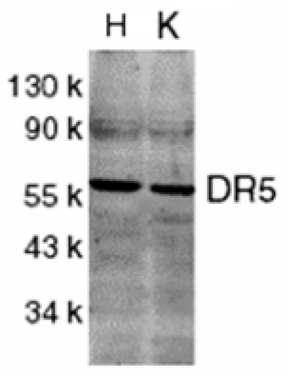 Western blot - DR5 Antibody from Signalway Antibody (24041) - Antibodies.com