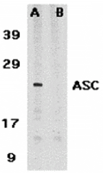 Western blot analysis of ASC in HL60 whole cell lysate in the absence (A) or presence (B) of blocking peptide (2287P) with ASC antibody at 1 µg /ml.